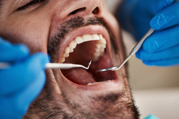 Best Emergency Treatment for Toothache in Niantic, CT